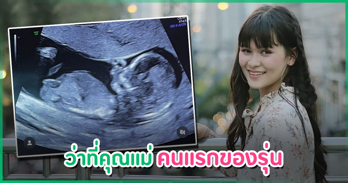 แห่ยินดี-!-อดีตสมาชิก-bnk48-ประกาศข่าวดีตั้งท้อง-เตรียมเป็นว่าที่คุณแม่คนแรกของรุ่น