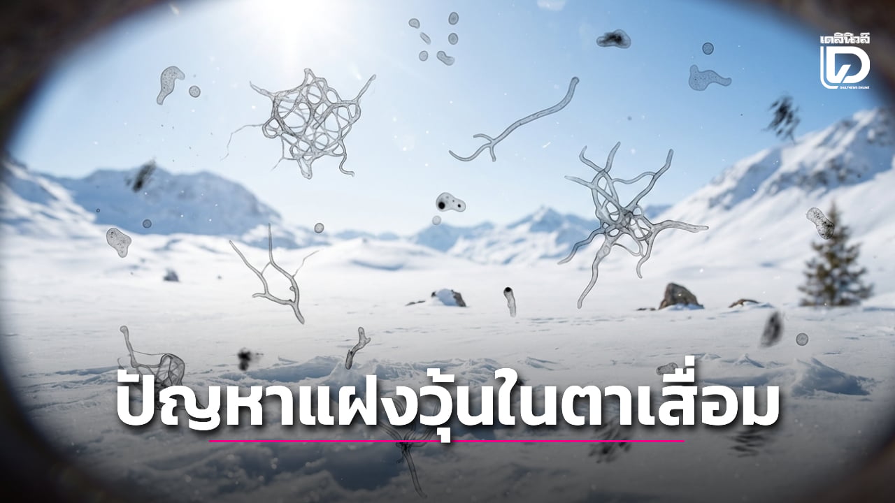 ผลการศึกษาชี้-การมองเห็น-‘หยากไย่ลอยไปมา’-ในตา-อาจบอกปัญหาสุขภาพร้ายแรงได้ -|-เดลินิวส์