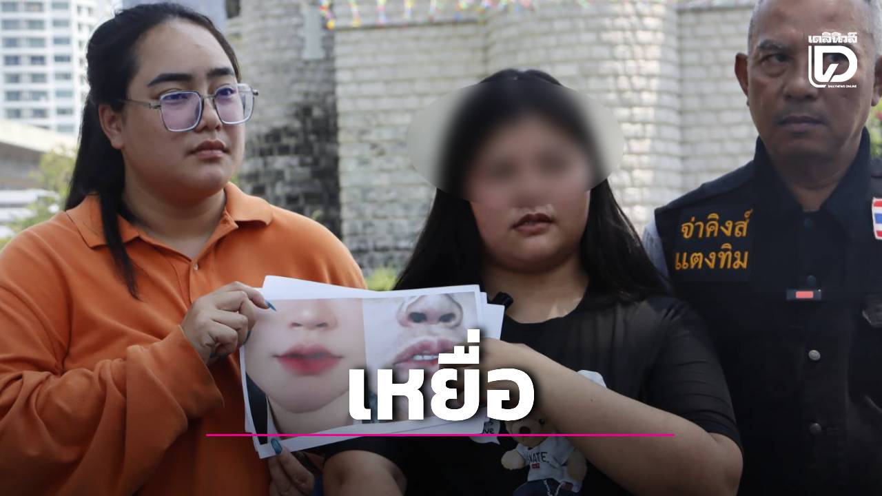 แชร์ศัลยกรรมทำสยอง!-สาว-21-หน้าพังปากเบี้ยว-ยิ้มไม่ได้-น้ำไหลหยด-แฉคลินิกขู่ฟ้องปิดปาก-|-เดลินิวส์