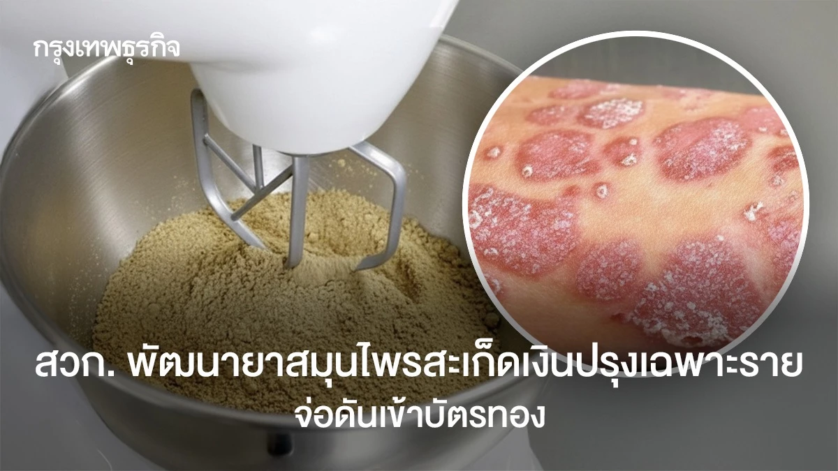 สวก.-พัฒนายาสมุนไพรสะเก็ดเงินปรุงเฉพาะราย-จ่อดันเข้าบัตรทอง